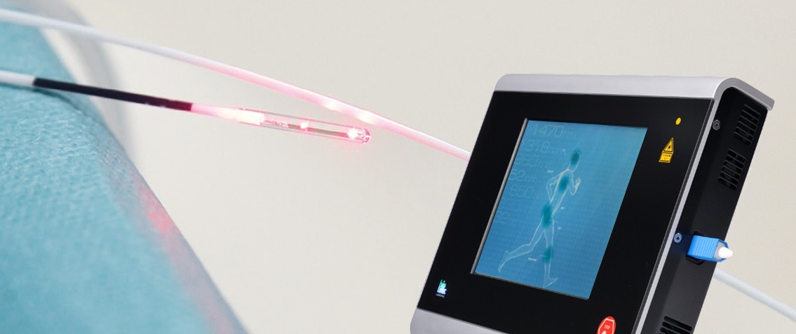 Eleminimi Variceve laser