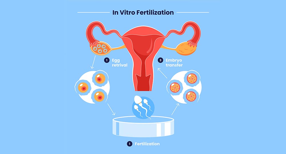 procesi vertilizimit